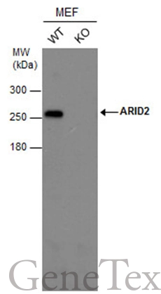 ARID2 antibody [GT7311]
