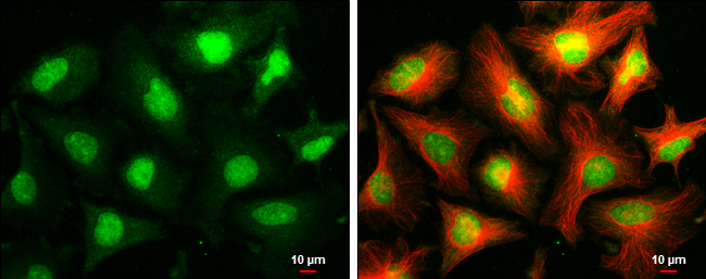 ARID2 antibody [GT7311]