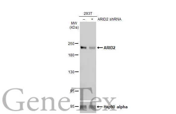 ARID2 antibody [GT7311]
