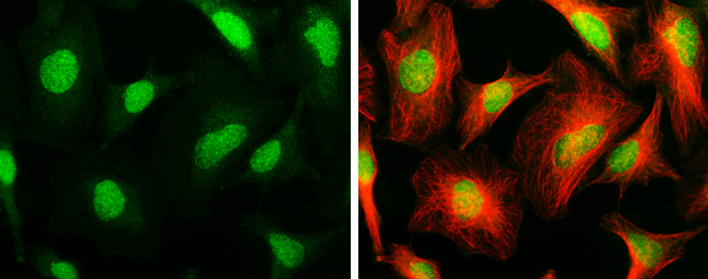 ARID1A antibody [GT3611] detects ARID1A protein at nucleus by immunofluorescent analysis. Sample: HeLa cells were fixed in ice-cold MeOH for 5 min. Green: ARID1A stained by ARID1A antibody [GT3611] (GTX632013) diluted at 1:200. Red: alpha Tubulin 4a, a cytoskeleton marker, stained by alpha Tubulin 4a antibody (GTX112141) diluted at 1:500.