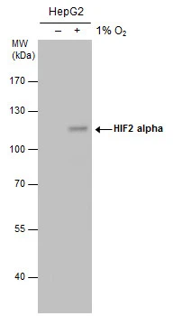 HIF2 alpha antibody [GT125]