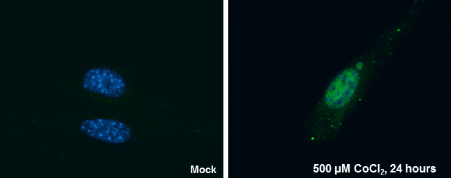 Anti-HIF2 alpha antibody [GT125] (GTX632015) | GeneTex