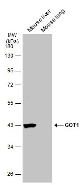 Various tissue extracts (30 μg) were separated by 10% SDS-PAGE, and the membrane was blotted with GOT1 antibody [GT638] (GTX632031) diluted at 1:5000. The HRP-conjugated anti-mouse IgG antibody (GTX213111-01) was used to detect the primary antibody.