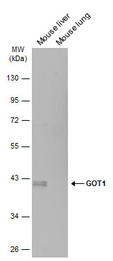 GOT1 antibody [GT1342]