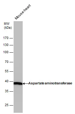 GOT1 antibody [GT1255]
