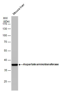 GOT1 antibody [GT1255]