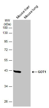 GOT1 antibody [GT1255]