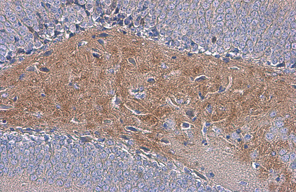 Anti-C9orf72 antibody [GT779] (GTX632041) | GeneTex