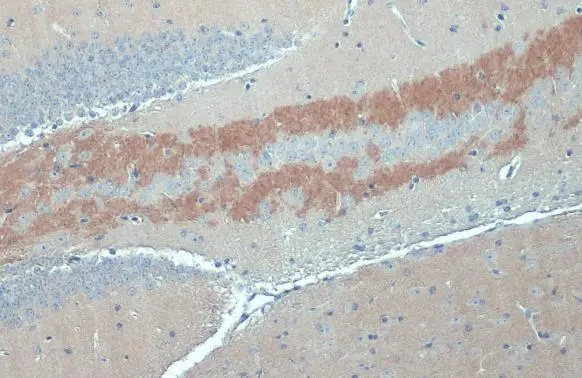Anti-C9orf72 antibody [GT779] (GTX632041) | GeneTex