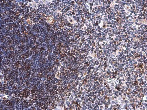 DCK antibody [GT7710] detects DCK protein at nucleus by immunohistochemical analysis. Sample: Paraffin-embedded mouse thymus gland. DCK stained by DCK antibody [GT7710] (GTX632062) diluted at 1:200.
 Antigen Retrieval: Citrate buffer, pH 6.0, 15 min