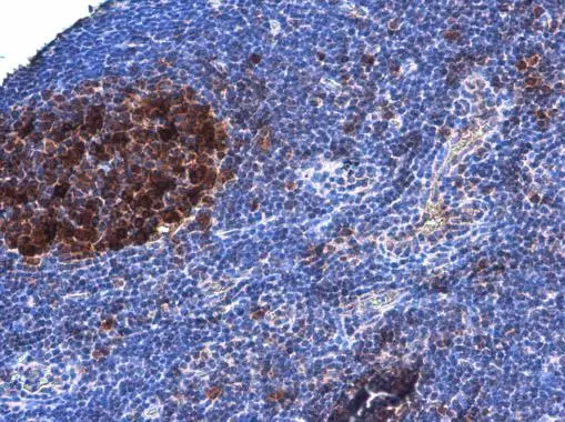 DCK antibody [GT7710] detects DCK protein at nucleus by immunohistochemical analysis. Sample: Paraffin-embedded rat lymph node. DCK stained by DCK antibody [GT7710] (GTX632062) diluted at 1:200.
 Antigen Retrieval: Citrate buffer, pH 6.0, 15 min