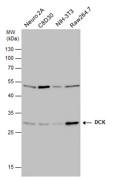 DCK antibody [GT10412] detects DCK protein by western blot analysis. Various whole cell extracts (30 μg) were separated by 12% SDS-PAGE, and the membrane was blotted with DCK antibody [GT10412] (GTX632065) diluted at a dilution of 1:500.