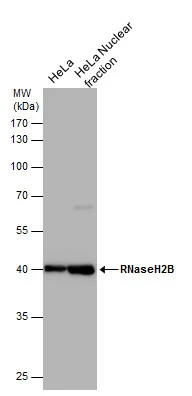 RNaseH2B antibody detects RNaseH2B protein by western blot analysis. HeLa whole cell extracts and nuclear extracts (30 μg) were separated by 10% SDS-PAGE, and the membrane was blotted with RNaseH2B antibody (GTX632104) at a dilution of 1:1000.