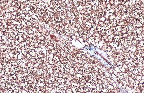 UCP1 antibody [GT3111]