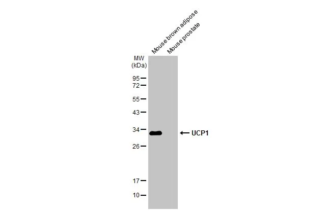 UCP1 antibody [GT1345]