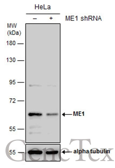 Non-transfected (–) and transfected (+) HeLa whole cell extracts (30 μg) were separated by 7.5% SDS-PAGE, and the membrane was blotted with ME1 antibody [GT736] (GTX632188) diluted at 1:500.