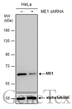 Non-transfected (–) and transfected (+) HeLa whole cell extracts (30 μg) were separated by 7.5% SDS-PAGE, and the membrane was blotted with ME1 antibody [GT979] (GTX632189) diluted at 1:1000.
