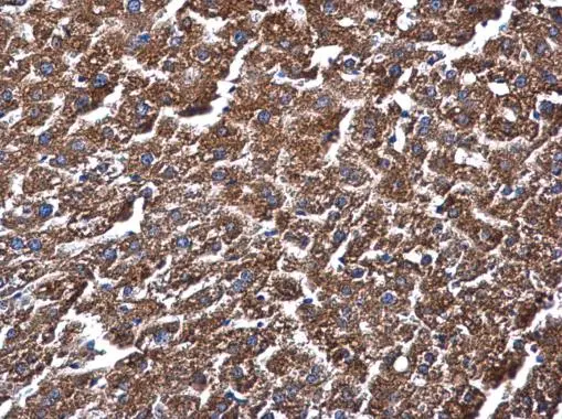 ME1 antibody [GT15611] detects ME1 protein at cytoplasm in mouse liver by immunohistochemical analysis. Sample: Paraffin-embedded mouse liver. ME1 antibody [GT15611] (GTX632190) diluted at 1:500. 
 Antigen Retrieval: Citrate buffer, pH 6.0, 15 min