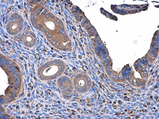 ME1 antibody [GT15611] detects ME1 protein at cytoplasm in mouse cervix by immunohistochemical analysis. Sample: Paraffin-embedded mouse cervix. ME1 antibody [GT15611] (GTX632190) diluted at 1:500. 
 Antigen Retrieval: Citrate buffer, pH 6.0, 15 min