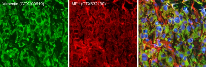 Double-labeled immunofluorescence photomicrographs of frozen sections of mouse brain. Green: Vimentin antibody (GTX100619) diluted at 1:200. The signal was developed using goat anti-rabbit IgG antibody (Dylight488) (GTX213110-04). Red: ME1 antibody [GT15611] (GTX632190) diluted at 1:200. The signal was developed using goat anti-mouse IgG antibody (Dylight594) (GTX213111-05). Blue: Nuclear staining with Hoechst 33342. 
 Antigen Retrieval: Citrate buffer, pH 6.0, 15 min