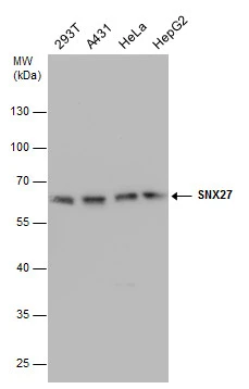 SNX27 antibody detects SNX27 protein by western blot analysis. Various whole cell extracts (30 ug) were separated by 10% SDS-PAGE,and the membrane was blotted with SNX27 antibody (GTX632193) diluted at a dilution of 1:500.