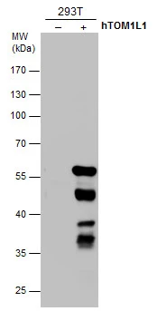 TOM1L1 antibody detects TOM1L1 protein by western blot analysis. Non-transfected (-) and TOM1L1-transfected (+) 293T whole cell extracts (30 μg) were separated by 10% SDS-PAGE, and the membrane was blotted with TOM1L1 antibody (GTX632246) diluted at 1:1000. TOM1L1 antibody detects TOM1L1 protein by western blot analysis. Non-transfected (-) and TOM1L1-transfected (+) 293T whole cell extracts (30 μg) were separated by 10% SDS-PAGE, and the membrane was blotted with TOM1L1 antibody (GTX632246) diluted at 1:1000.