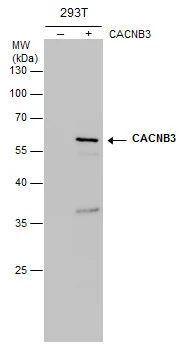 CACNB3 antibody detects CACNB3 protein by western blot analysis.Non-transfected (-) and CACNB3-transfected (+,) 293T whole cell extracts (30 ug) were separated by 10% SDS-PAGE,and the membrane was blotted with CACNB3 antibody at a dilution of 1:1000.