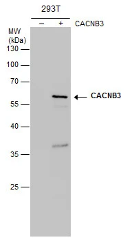 CACNB3 antibody detects CACNB3 protein by western blot analysis. Non-transfected (-) and CACNB3-transfected (+, ) 293T whole cell extracts (30 μg) were separated by 10% SDS-PAGE, and the membrane was blotted with CACNB3 antibody (GTX632268) at a dilution of 1:1000.