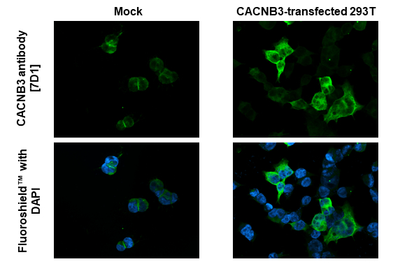 CACNB3 antibody [7D1] detects CACNB3 protein by immunofluorescent analysis. Sample: Mock and transfected 293T cells were fixed in ice-cold MeOH for 5 min. Green: CACNB3 stained by CACNB3 antibody [7D1] (GTX632268) diluted at 1:500. Blue: Fluoroshield with DAPI (GTX30920).
