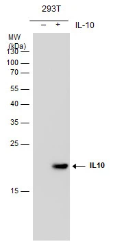 IL10 antibody [GT5111]