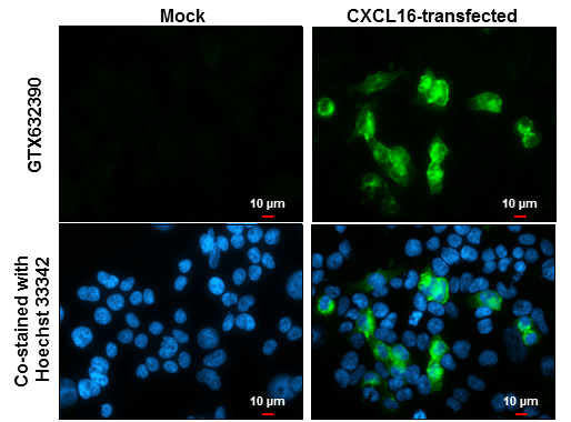 CXCL16 antibody [GT5212] detects CXCL16 protein by immunofluorescent analysis. Sample: Mock and transfected 293T cells were fixed in 4% paraformaldehyde at RT for 15 min. Green: CXCL16 stained by CXCL16 antibody [GT5212] (GTX632390) diluted at 1:2000. Blue: Hoechst 33342 staining. Scale bar= 10μm.
