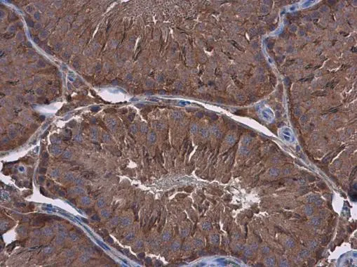 Filamin B antibody [GT387]