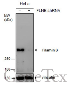 Filamin B antibody [GT387]