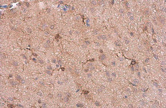 Iba1 antibody [GT10312] detects Iba1 protein at cytoplasm by immunohistochemical analysis. Sample:Paraffin-embedded mouse brain. Iba1 stained by Iba1 antibody [GT10312] (GTX632426) diluted at 1:200. Antigen Retrieval:Citrate buffer,pH 6.0,15 min