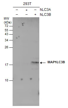 Non-transfected (–) and transfected (+) 293T whole cell extracts (30 μg) were separated by 15% SDS-PAGE, and the membrane was blotted with LC3B antibody [GT3612] (GTX632501) diluted at 1:500.
