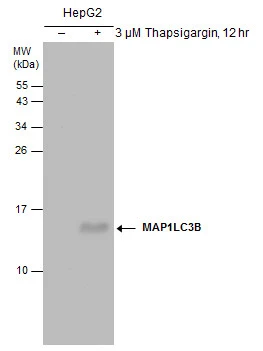 Untreated (–) and treated (+) HepG2 whole cell extracts (30 μg) were separated by 15% SDS-PAGE, and the membrane was blotted with LC3B antibody [GT3612] (GTX632501) diluted at 1:500.