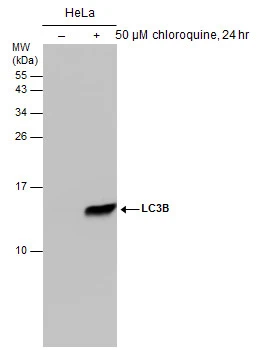 Untreated (–) and treated (+) HeLa whole cell extracts (50 μg) were separated by 15% SDS-PAGE, and the membrane was blotted with LC3B antibody [GT3612] (GTX632501) diluted at 1:500.