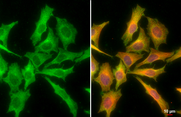 CXCL16 antibody [GT516] detects CXCL16 protein at cytoplasm by immunofluorescent analysis. Sample: HeLa cells were fixed in 4% paraformaldehyde at RT for 15 min. Green: CXCL16 stained by CXCL16 antibody [GT516] (GTX632502) diluted at 1:500. Red: beta Tubulin, a cytoskeleton marker, stained by beta Tubulin antibody (GTX101279) diluted at 1:1000. Blue: Fluoroshield with DAPI (GTX30920). Scale bar= 10μm.