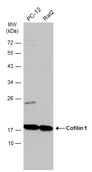 Various whole cell extracts (30 μg) were separated by 12% SDS-PAGE, and the membrane was blotted with Cofilin 1 antibody [GT217] (GTX632582) diluted at 1:1000. The HRP-conjugated anti-mouse IgG antibody (GTX213111-01) was used to detect the primary antibody.