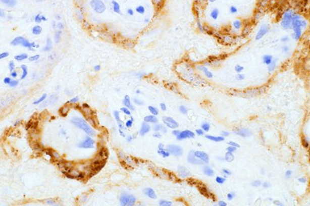 Anti-SARS-CoV / SARS-CoV-2 (COVID-19) spike antibody [1A9