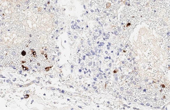 Anti-SARS-CoV / SARS-CoV-2 (COVID-19) spike antibody [1A9