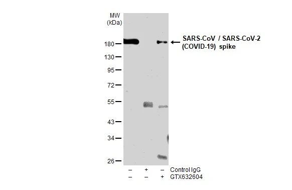 実働品　CORONA STANDARD コロナタイプライター　AZERT配列 Anti-SARS-CoV / SARS-CoV-2 (COVID-19) spike antibody [1A9
