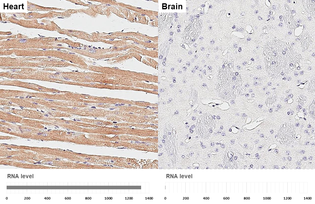 MYH6 antibody [GT5612] detects MYH6 protein by immunohistochemical analysis. Sample: Paraffin-embedded mouse tissues. MYH6 stained by MYH6 antibody [GT5612] (GTX632649) diluted at 1:200. Antigen Retrieval: Citrate buffer, pH 6.0, 15 min