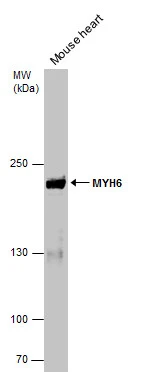 Mouse tissue extract (50 μg) was separated by 5% SDS-PAGE, and the membrane was blotted with MYH6 antibody [GT565] (GTX632650) diluted at 1:5000.