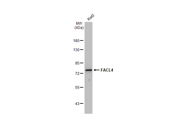 Whole cell extract (30 μg) was separated by 7.5% SDS-PAGE, and the membrane was blotted with FACL4 antibody [GT566] (GTX632675) diluted at 1:1000. The HRP-conjugated anti-mouse IgG antibody (GTX213111-01) was used to detect the primary antibody.