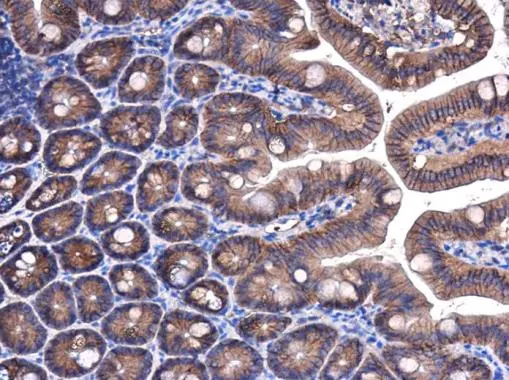 beta Catenin antibody [GT3171] detects beta Catenin protein at cell membrane and cytoplasm in mouse intestine by immunohistochemical analysis. Sample: Paraffin-embedded mouse intestine. beta Catenin antibody [GT3171] (GTX632676) diluted at 1:400. 
 Antigen Retrieval: Citrate buffer, pH 6.0, 15 min