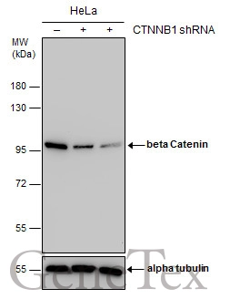 Non-transfected (–) and transfected (+) HeLa whole cell extracts (30 μg) were separated by 7.5% SDS-PAGE, and the membrane was blotted with beta Catenin antibody [GT3171] (GTX632676) diluted at 1:1000.