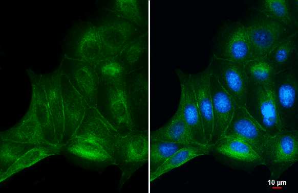 beta Catenin antibody detects beta Catenin protein at cell membrane and cytoplasm by immunofluorescent analysis. Sample: MDCK cells were fixed in 4% paraformaldehyde at RT for 15 min. Green: beta Catenin stained by beta Catenin antibody (GTX632676) diluted at 1:1000.