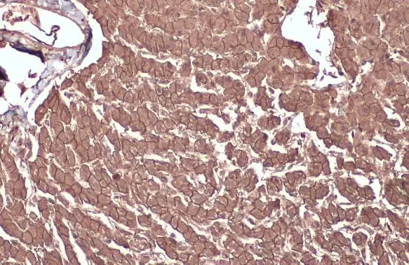 beta Catenin antibody detects beta Catenin protein at cell membrane by immunohistochemical analysis. Sample: Paraffin-embedded cat liver. beta Catenin stained by beta Catenin antibody (GTX632676) diluted at 1:200. Antigen Retrieval: Citrate buffer, pH 6.0, 15 min beta Catenin antibody detects beta Catenin protein at cell membrane by immunohistochemical analysis. Sample: Paraffin-embedded cat liver. beta Catenin stained by beta Catenin antibody (GTX632676) diluted at 1:200. Antigen Retrieval: Citrate buffer, pH 6.0, 15 min