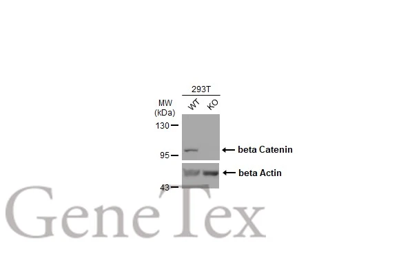 Wild-type (WT) and beta Catenin knockout (KO) 293T cell extracts (30 μg) were separated by 7.5% SDS-PAGE, and the membrane was blotted with beta Catenin antibody [GT3171] (GTX632676) diluted at 1:500. The HRP-conjugated anti-mouse IgG antibody (GTX213111-01) was used to detect the primary antibody, and the signal was developed with Trident ECL plus-Enhanced.